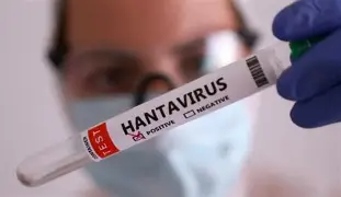 François Deplanque — Hantavirus en France : ce que le CSE doit faire maintenant